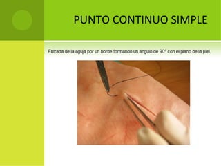 PUNTO CONTINUO SIMPLE

 