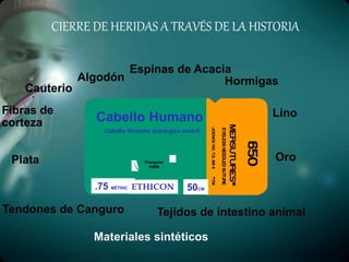 CIERRE DE HERIDAS A TRAVÉS DE LA HISTORIA
Cauterio
Espinas de Acacia
Hormigas
Fibras de
corteza
OroPlata
Tendones de Canguro
Lino
Tejidos de intestino animal
Algodón
Materiales sintéticos
Cabello Humano
Cabello Humano quirúrgico estéril
.75 MÉTRICO
Triangular
16MM
50CMETHICON
 
