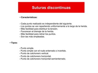 • Tipos:
- Punto simple.
- Punto simple con el nudo enterrado o invertido.
- Punto de colchonero vertical.
- Punto de colchonero horizontal.
- Punto de colchonero horizontal semienterrado.
- Cada punto realizado es independiente del siguiente.
- Los puntos se van repartiendo uniformemente a lo largo de la herida.
- Más facilidad para distribuir la tensión.
- Favorecen el drenaje de la herida.
- Más facilidad para retirar los puntos.
- Son las más empleadas.
• Características:
Suturas discontinuas
Suturas discontinuas
 