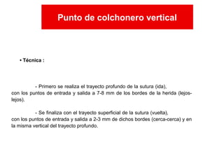 • Técnica :
- Primero se realiza el trayecto profundo de la sutura (ida),
con los puntos de entrada y salida a 7-8 mm de los bordes de la herida (lejos-
lejos).
- Se finaliza con el trayecto superficial de la sutura (vuelta),
con los puntos de entrada y salida a 2-3 mm de dichos bordes (cerca-cerca) y en
la misma vertical del trayecto profundo.
Punto de colchonero vertical
Punto de colchonero vertical
 