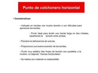 - Indicado en heridas con mucha tensión o con dificultad para
aproximar los bordes.
- Punto ideal para dividir una herida larga en dos mitades,
repartiendo la tensión entre ambas.
- Previene la dehiscencia de suturas.
- Proporciona una buena eversión de los bordes.
- Punto muy estético (las líneas de tensión son paralelas a la
incisión, no dejando “marcas horizontales”.
- Se realiza con material no reabsorbible.
Punto de colchonero horizontal
• Características:
Punto de colchonero horizontal
 