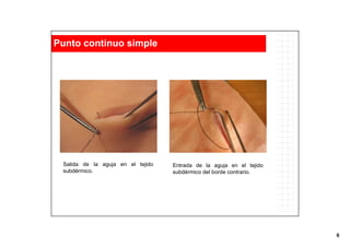 6
Entrada de la aguja en el tejido
subdérmico del borde contrario.
Salida de la aguja en el tejido
subdérmico.
Punto continuo simple
 