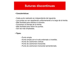 • Tipos:
- Punto simple.
- Punto simple con el nudo enterrado o invertido.
- Punto de colchonero vertical.
- Punto de colchonero horizontal.
- Punto de colchonero horizontal semienterrado.
- Cada punto realizado es independiente del siguiente.
- Los puntos se van repartiendo uniformemente a lo largo de la herida.
- Más facilidad para distribuir la tensión.
- Favorecen el drenaje de la herida.
- Más facilidad para retirar los puntos.
- Son las más empleadas.
• Características:
Suturas discontinuas
Suturas discontinuas
 