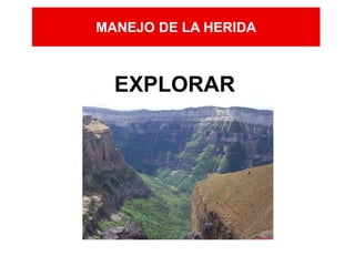 MANEJO DE LA HERIDA
EXPLORAR
 