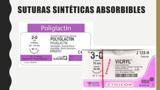 SUTURAS SINTÉTICAS ABSORBIBLES
 