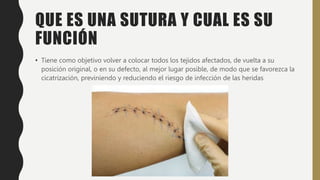 QUE ES UNA SUTURA Y CUAL ES SU
FUNCIÓN
• Tiene como objetivo volver a colocar todos los tejidos afectados, de vuelta a su
posición original, o en su defecto, al mejor lugar posible, de modo que se favorezca la
cicatrización, previniendo y reduciendo el riesgo de infección de las heridas
 