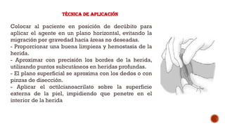 Técnica de aplicación
Colocar al paciente en posición de decúbito para
aplicar el agente en un plano horizontal, evitando la
migración por gravedad hacia áreas no deseadas.
­
- Proporcionar una buena limpieza y hemostasia de la
herida.
­
- Aproximar con precisión los bordes de la herida,
utilizando puntos subcutáneos en heridas profundas.
­
- El plano superficial se aproxima con los dedos o con
pinzas de disección.
-­ Aplicar el octilcianoacrilato sobre la superficie
externa de la piel, impidiendo que penetre en el
interior de la herida
 
