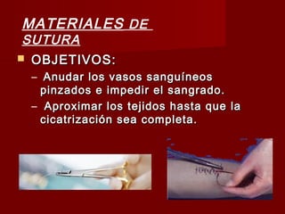  OBJETIVOS:OBJETIVOS:
– Anudar los vasos sanguíneosAnudar los vasos sanguíneos
pinzados e impedir el sangrado.pinzados e impedir el sangrado.
– Aproximar los tejidos hasta que laAproximar los tejidos hasta que la
cicatrización sea completa.cicatrización sea completa.
MATERIALES DE
SUTURA
 