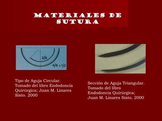Tipo de Aguja Circular.
Tomado del libro Endodoncia
Quirúrgica; Juan M. Linares
Sixto. 2000
Sección de Aguja Triangular.
Tomado del libro
Endodoncia Quirúrgica;
Juan M. Linares Sixto. 2000
MATERIALES DE
SUTURA
 