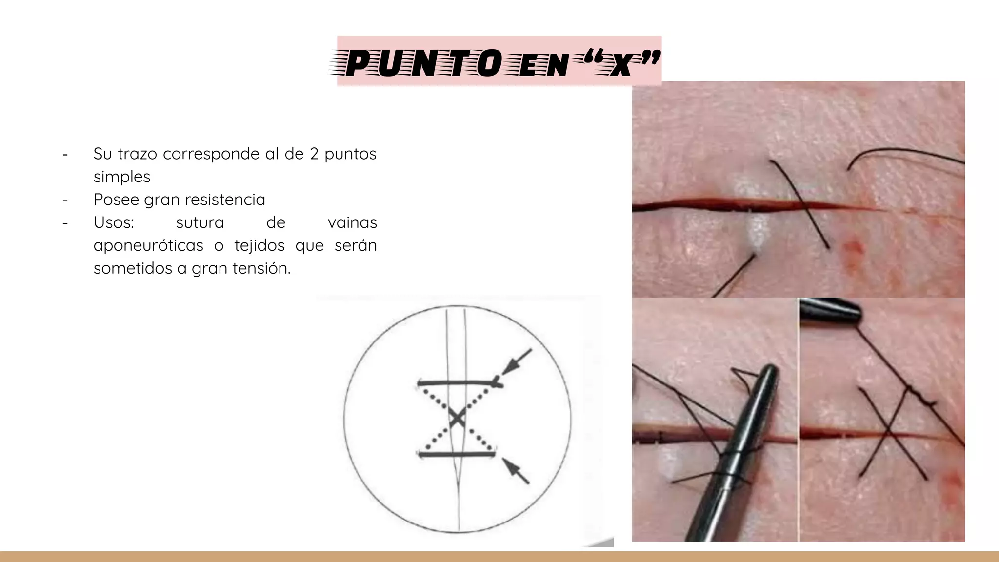 suturas-nudos-ligaduras-y-puntos-de-sutura-1-pdf