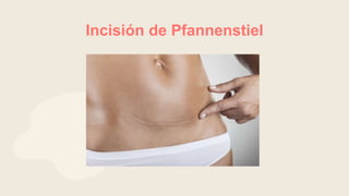 Suturas, puntos e incisiones cirugia I_101531.pptx