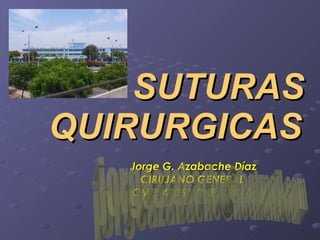SUTURAS  QUIRURGICAS Jorge G. Azabache Díaz CIRUJANO GENERAL CMP: 41051  RNE: 19263 [email_address] 