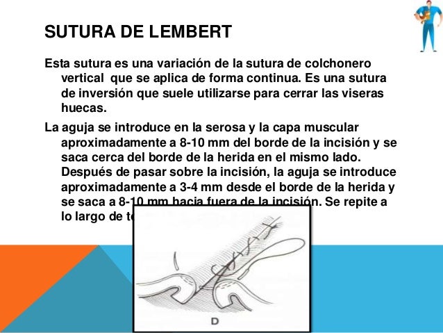 Suturas, terminologia quirurgica y clasificacion de las