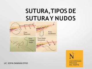 SUTURA,TIPOS DE
SUTURAY NUDOS
LIC. SOFIA DAMIAN EFFIO
 