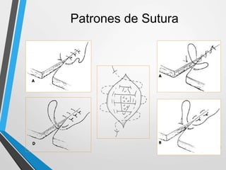 Patrones de Sutura
 