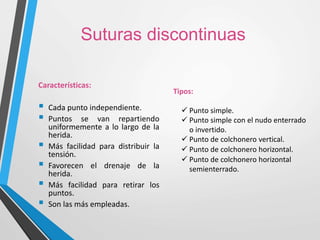Suturas discontinuas
Características:
 Cada punto independiente.
 Puntos se van repartiendo
uniformemente a lo largo de la
herida.
 Más facilidad para distribuir la
tensión.
 Favorecen el drenaje de la
herida.
 Más facilidad para retirar los
puntos.
 Son las más empleadas.
Tipos:
 Punto simple.
 Punto simple con el nudo enterrado
o invertido.
 Punto de colchonero vertical.
 Punto de colchonero horizontal.
 Punto de colchonero horizontal
semienterrado.
 