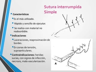  Características
Es el más utilizado.
 Rápido y sencillo de ejecutar.
 Se realiza con material no
reabsorbible.
Indicaciones
Laceraciones, reaproximación de
bordes.
En zonas de tensión,
supraarticulares.
Contraindicaciones: heridas
sucias, con signos de infección,
necrosis, mala vascularización.
Sutura interrumpida
Simple
 