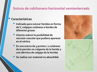  Características
 Indicado para suturar heridas en forma
deV, colgajos cutáneos o bordes de
diferente grosor.
 Intenta reducir la posibilidad de
necrosis vascular que pudiera aparecer
en el vértice
 Es una sutura de 3 puntos ( 2 cutáneos
de la porción no colgante de la herida y
uno dérmico de colgajo de la herida)
 Se realiza con material no absorbible
Sutura de colchonero horizontal semienterrado
 