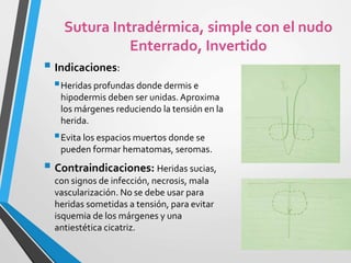  Indicaciones:
Heridas profundas donde dermis e
hipodermis deben ser unidas. Aproxima
los márgenes reduciendo la tensión en la
herida.
Evita los espacios muertos donde se
pueden formar hematomas, seromas.
 Contraindicaciones: Heridas sucias,
con signos de infección, necrosis, mala
vascularización. No se debe usar para
heridas sometidas a tensión, para evitar
isquemia de los márgenes y una
antiestética cicatriz.
Sutura Intradérmica, simple con el nudo
Enterrado, Invertido
 