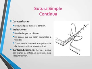  Características
Dificultad para ajustar la tensión.
 Indicaciones:
Heridas largas, rectilíneas.
En zonas que no están sometidas a
tensión.
Zonas donde la estética es primordial
(la forma continua intradérmica).
 Contraindicaciones: heridas sucias,
con signos de infección, necrosis, mala
vascularización.
Sutura Simple
Continua
 