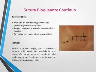 Características:
 Muy útil en heridas de gran tensión,
permite ajustarlas muy bien.
 Proporciona una adecuada eversión de los
bordes.
 Se realiza con material no reabsorbible.
Técnica :
Similar al punto simple, con la diferencia
respecto a él, que el hilo de salida de cada
punto efectuado, se pasa por dentro del
bucle antes de tensionar, con lo que se
produce el bloqueo del hilo.
Sutura Bloqueante Continuo
 
