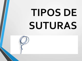 TIPOS DE
SUTURAS
 