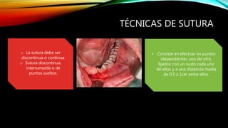 TÉCNICAS DE SUTURA
• Consiste en efectuar en puntos
idependientes uno de otro,
fijados con un nudo cada uno
de ellos y a una distancia media
de 0.5 a 1cm entre ellos.
o La sutura debe ser
discontinua o continua.
o Sutura discontinua,
interrumpida o de
puntos sueltos.
 