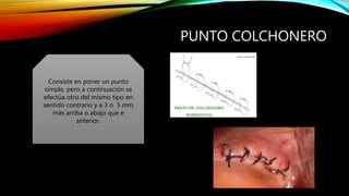 PUNTO COLCHONERO
Consiste en poner un punto
simple, pero a continuación se
efectúa otro del mismo tipo en
sentido contrario y a 3 o 5 mm
más arriba o abajo que e
anterior.
 