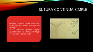 SUTURA CONTINUA SIMPLE
Se coloca un punto simple, se anuda y
se secciona el extremo libre que no
tiene aguja.
Se va colocando puntos simples
separados entre 5 a 10mm, hasta llegar
al otro extremo de la incisión.
 