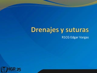 R1CG Edgar Vargas
 