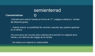 semienterrad
o
• Características:
-Indicado para suturar heridas en forma de “V”, colgajos cutáneos o bordes
de diferente grosor.
- Intenta reducir la posibilidad de necrosis vascular que pudiera aparecer
en el vértice.
-Es una sutura de 3 puntos (dos cutáneos de la porción no colgante de la
herida y uno dérmico del colgajo de la herida).
- Se realiza con material no reabsorbible.
 