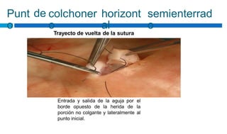 Punt
o
de colchoner
o
horizont
al
semienterrad
o
Trayecto de vuelta de la sutura
Entrada y salida de la aguja por
borde opuesto de la herida de
porción no colgante y lateralmente
punto inicial.
el
la
al
 