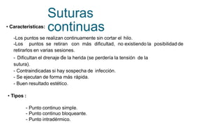 Suturas
continuas
• Características:
-Los puntos se realizan continuamente sin cortar el hilo.
-Los puntos se retiran con más dificultad, no existiendo la posibilidad de
retirarlos en varias sesiones.
- Dificultan el drenaje de la herida (se perdería la tensión
sutura).
de la
- Contraindicadas si hay sospecha de
- Se ejecutan de forma más rápida.
- Buen resultado estético.
infección.
• Tipos :
- Punto continuo simple.
- Punto continuo bloqueante.
- Punto intradérmico.
 