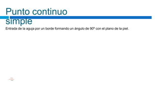 Punto continuo
simple
Entrada de la aguja por un borde formando un ángulo de 90º con el plano de la piel.
área
• científica
NI.NAAINI
 