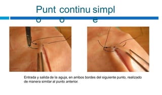 Punt
o
continu
o
simpl
e
Entrada y salida de la aguja, en ambos bordes del siguiente punto, realizado
de manera similar al punto anterior.
 