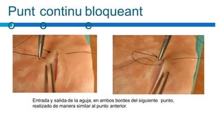 Punt
o
continu
o
bloqueant
e
Entrada y salida de la aguja, en ambos bordes del siguiente
realizado de manera similar al punto anterior.
punto,
 