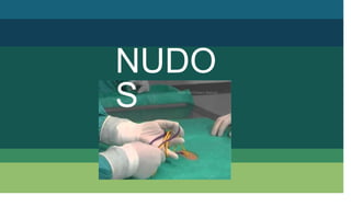 NUDO
S
 