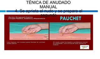TÉNICA DE ANUDADO
MANUAL
4. Se aprieta el nudo y se prepara el
segundo
 