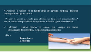 Disminuir la tensión de la herida antes de cerrarla, mediante disección
dermograsa con tijera o bisturí.
Aplicar la tensión adecuada para afrontar los tejidos sin isquemizarlos. A
mayor tensión más posibilidad de isquemia e infección y peor cicatrización.
 Colocar el mínimo número de puntos que consiga una buena
aproximación de los bordes y elimine los espacios muertos.
• Tipos:
- Discontinuas
- Continuas
 