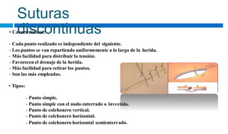 rtido.
ado.
Suturas
discontinuas
• Características:
- Cada punto realizado es independiente del siguiente.
- Los puntos se van repartiendo uniformemente a lo largo de la herida.
- Más facilidad para distribuir la tensión.
- Favorecen el drenaje de la herida.
- Más facilidad para retirar los puntos.
- Son las más empleadas.
• Tipos:
- Punto simple.
- Punto simple con el nudo enterrado o inve
- Punto de colchonero vertical.
- Punto de colchonero horizontal.
- Punto de colchonero horizontal semienterr
 