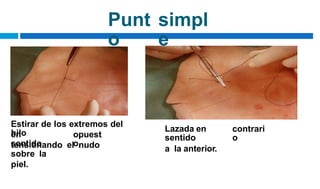 Punt
o
simpl
e
Estirar de los extremos del
hilo Lazada en
sentido
a la anterior.
contrari
o
en
sentido
opuest
o,
tensionando el nudo
sobre la
piel.
 