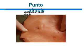 Punto
simple
Visión de un punto
simple.
 