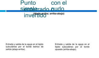 Punto
simple
con el
nudo
enterrado o
invertido
(Abajo-arriba; arriba-abajo)
Entrada y salida de la aguja en el tejido
subcutáneo por el borde teórico de
salida (abajo-arriba).
Entrada y salida de la aguja en el
tejido subcutáneo por el borde
opuesto (arriba-abajo).
 