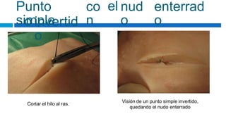 Punto
simple
co
n
el nud
o
enterrad
o
o invertid
o
Visión de un punto simple invertido,
quedando el nudo enterrado
Cortar el hilo al ras.
 