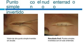 Punto
simple
invertido
co
n
el nud
o
enterrad
o
o
Visión de otro punto simple invertido
sin anudar.
Resultado final: Puntos simples
invertidos con el nudo enterrado.
 