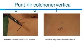 Punt
o
de colchoner
o
vertica
l
Lazada en sentido contrario a la anterior. Visión de un punto colchonero vertical.
 