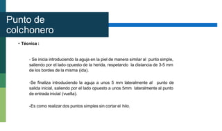 Punto de
colchonero
horizontal
• Técnica :
- Se inicia introduciendo la aguja en la piel de manera similar al punto simple,
saliendo por el lado opuesto de la herida, respetando la distancia de 3-5 mm
de los bordes de la misma (ida).
-Se finaliza introduciendo la aguja a unos 5 mm lateralmente al punto de
salida inicial, saliendo por el lado opuesto a unos 5mm lateralmente al punto
de entrada inicial (vuelta).
-Es como realizar dos puntos simples sin cortar el hilo.
 