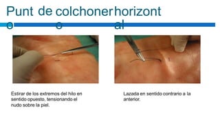 Punt
o
de colchoner
o
horizont
al
Estirar de los extremos del hilo en
sentido opuesto, tensionando el
nudo sobre la piel.
Lazada en sentido contrario a la
anterior.
 