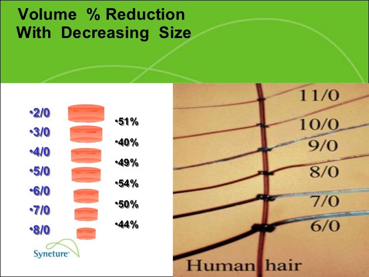 Suture Gauge Chart