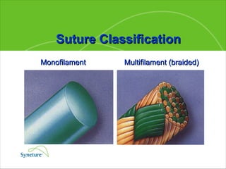 Multifilament (braided) Suture Classification Monofilament 
